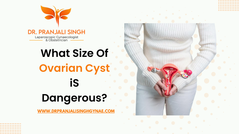 What size of ovarian cyst is dangerous? - Dr Pranjali Singh Dubai